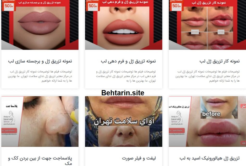 تزریق لب-عمل زیبایی
